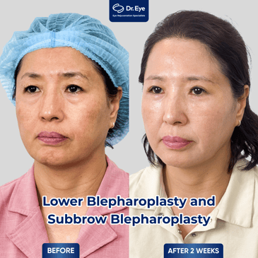 Slider image (9) Dr. Eye Aesthetic Clinic